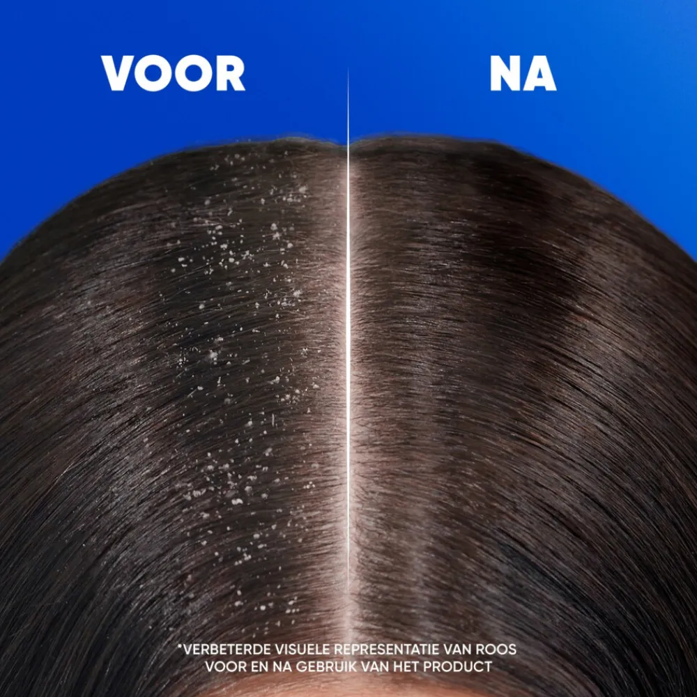 Head & Shoulders 2in1 Classic 400 ml