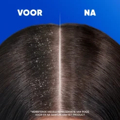 Head & Shoulders 2in1 Classic 625 ml
