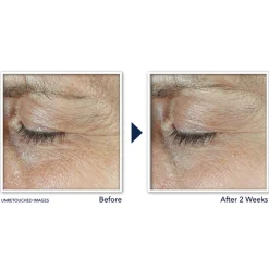 RoC Derm Correxion Dual Eye Cream 20 ml