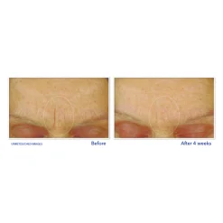 RoC Retinol Correxion Gezichtscrème Smoothing Max Hydration 50 ml