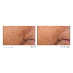 RoC Retinol Correxion Serum Nacht 10 stuks