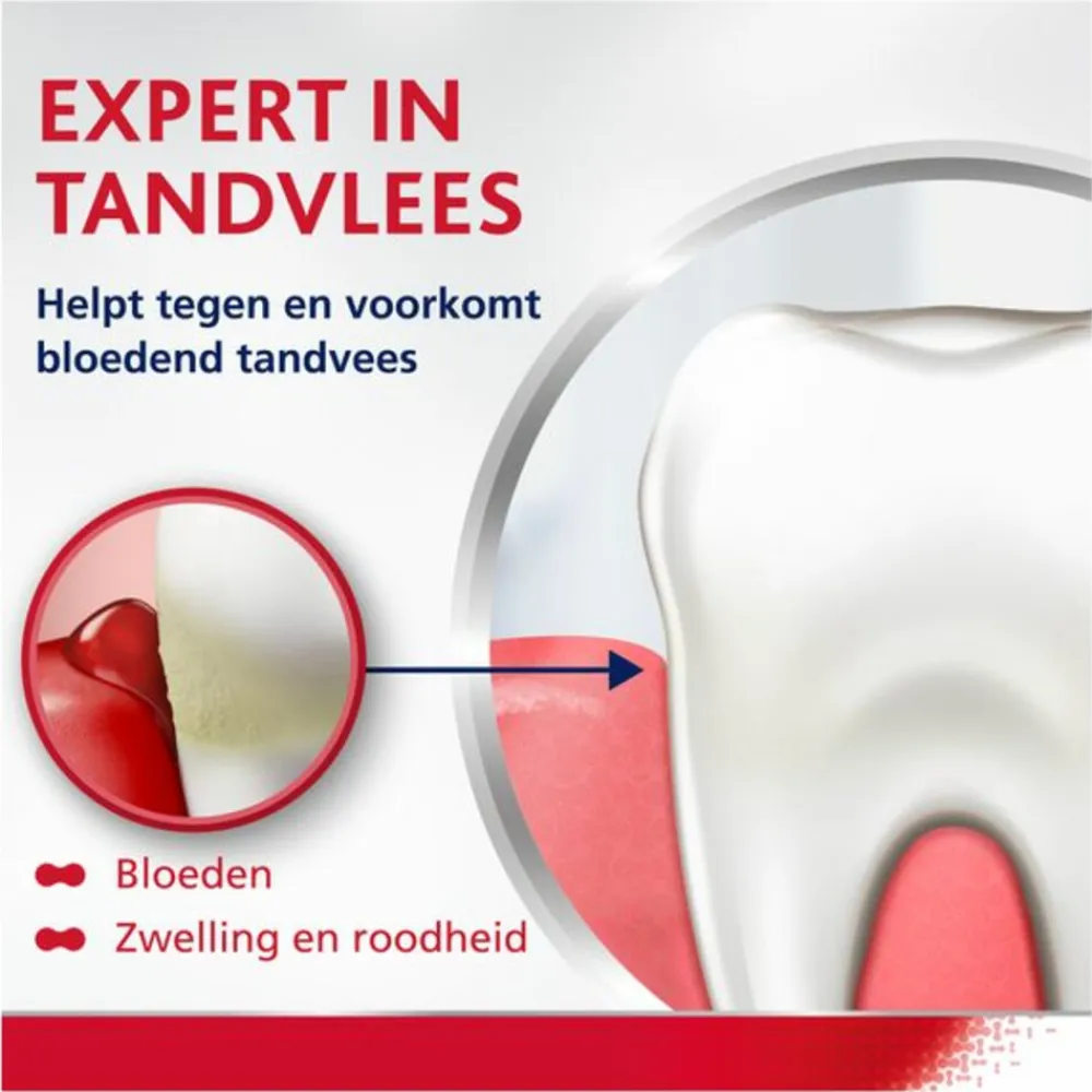 Parodontax 6x Complete Protection Extra Fresh tegen Bloeden Tandvlees 75 ml